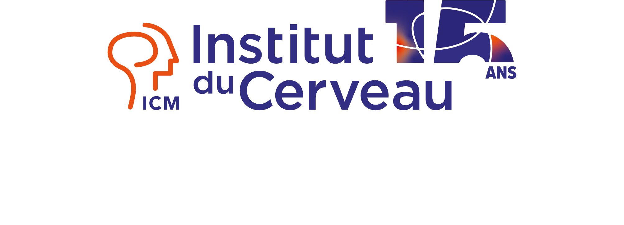 ICM